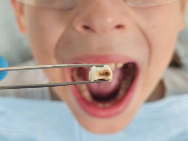 Best Same-Day Emergency Dental Services in Parsons, WV