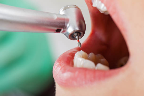 Best Emergency Denture Repair in Parsons, WV